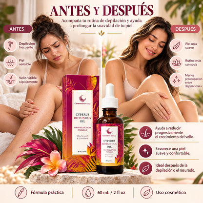 Caramela Beauty Cyperus Smooth™ – Aceite Post Depilación 60 ml 🌸